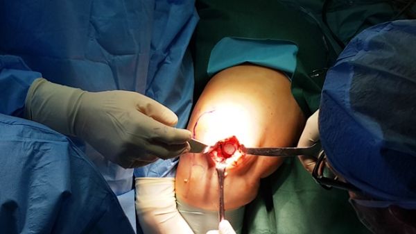 Sosnowieccy lekarze przetarli szlak BioPoly w województwie śląskim